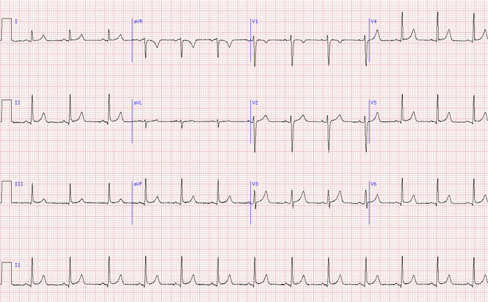 EKG ecografia cardiaca 